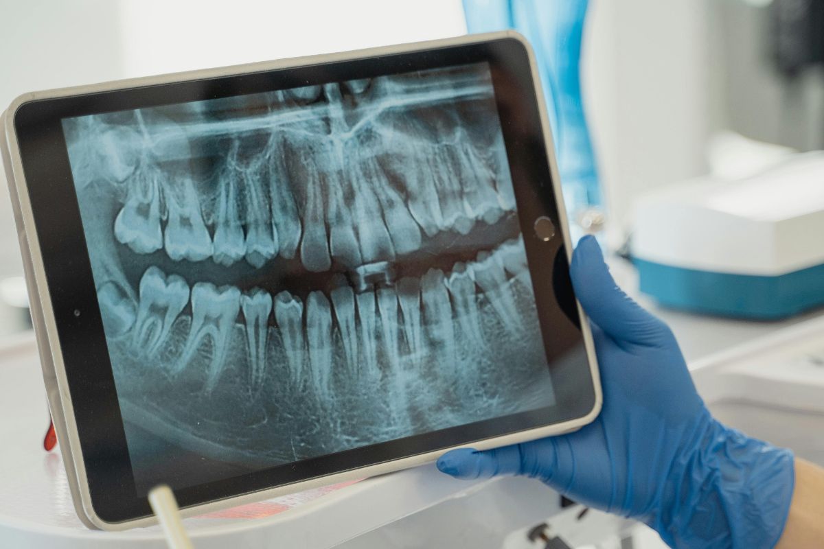 В Беларуси разрабатывают ИИ-помощника для стоматологов