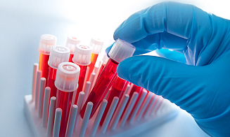 Врачи научились определять склонность к суициду по анализу крови