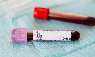 В Минске предлагают бесплатно пройти тестирование на гепатиты и ВИЧ