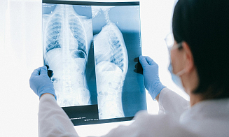 После ковида белорусы стали чаще болеть бронхиальной астмой