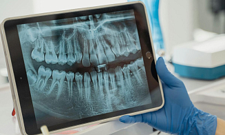 В Беларуси разрабатывают ИИ-помощника для стоматологов
