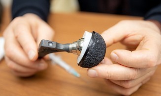 Доля отечественных изделий в травматологии за последние годы выросла больше чем втрое