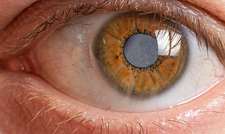 Катаракта: причины, симптомы и современные методы лечения