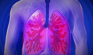 Переход на никотиносодержащую продукцию без горения как мера профилактики пневмонии 